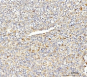 IHC staining of FFPE human spleen tissue with EIF3E antibody. HIER: boil tissue sections in pH8 EDTA for 20 min and allow to cool before testing.