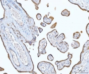 IHC staining of FFPE human placental tissue with EIF3E antibody. HIER: boil tissue sections in pH8 EDTA for 20 min and allow to cool before testing.