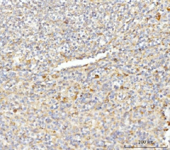 IHC staining of FFPE human spleen tissue with EIF3E antibody. HIER: boil tissue sections in pH8 EDTA for 20 min and allow to cool before testing.