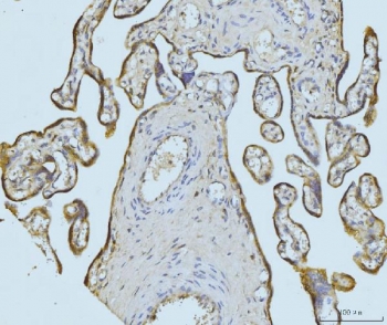 IHC staining of FFPE human placental tissue with ETFA antibody. HIER: boil tissue sections in pH8 EDTA for 20 min and allow to cool before testing.