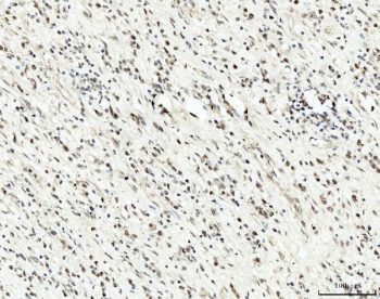 IHC staining of FFPE human gastric tissue with RRP4 antibody. HIER: boil tissue sections in pH8 EDTA for 20 min and allow to cool before testing.