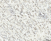 IHC staining of FFPE human gastric tissue with RRP4 antibody. HIER: boil tissue sections in pH8 EDTA for 20 min and allow to cool before testing.