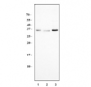 Western blot testing of human 1) HeLa, 2) A549 and 3) HEK293 cell lysate with EXOSC8 antibody. Expected molecular weight: 30-35 kDa.