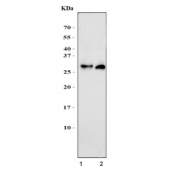 Western blot testing of 1) rat liver and 2) mouse liver lysate with Fcgr3 antibody. Expected molecular weight: 30-70 kDa depending on the level of glycosylation.