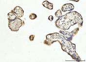 IHC staining of FFPE human placental tissue with FGF3 antibody. HIER: boil tissue sections in pH8 EDTA for 20 min and allow to cool before testing.