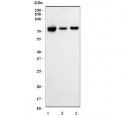 Western blot testing of human 1) A375, 2) 293T and 3) HeLa cell lysate with FKBP10 antibody. Expected molecular weight: 64-78 kDa.