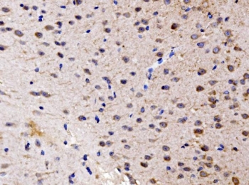 IHC staining of FFPE mouse brain tissue with FKBP15 antibody. HIER: boil tissue sections in pH8 EDTA for 20 min and allow to cool before testing.