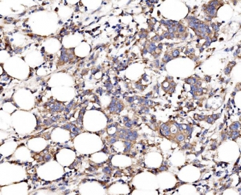 IHC staining of FFPE human breast tissue with FKBP15 antibody. HIER: boil tissue sections in pH8 EDTA for 20 min and allow to cool before testing.