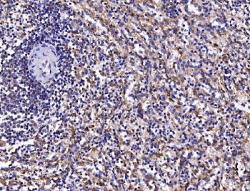 IHC staining of FFPE human spleen tissue with FKBP15 antibody. HIER: boil tissue sections in pH8 EDTA for 20 min and allow to cool before testing.