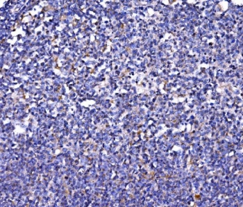 IHC staining of FFPE human tonsil tissue with FKBP15 antibody. HIER: boil tissue sections in pH8 EDTA for 20 min and allow to cool before testing.