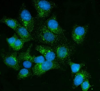 Immunofluorescent staining of FFPE human MCF7 cells with FKBP15 antibody (green) and DAPI nuclear stain (blue). HIER: steam section in pH6 citrate buffer for 20 min.
