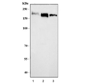 Western blot testing of 1) human HACAT, 2) human Raji and 3) mouse lung tissue lysate with FKBP15 antibody. Predicted molecular weight ~134 kDa.