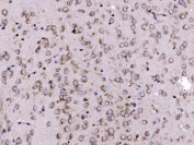 IHC staining of FFPE rat brain tissue with FKBP15 antibody. HIER: boil tissue sections in pH8 EDTA for 20 min and allow to cool before testing.