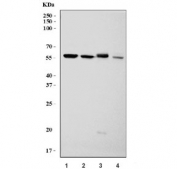 Western blot testing of 1) rat liver, 2) rat kidney, 3) mouse liver and 4) mouse kidney tissue lysate with FRK antibody. Predicted molecular weight ~58 kDa.