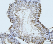 IHC staining of FFPE rat testis tissue with GHITM antibody. HIER: boil tissue sections in pH8 EDTA for 20 min and allow to cool before testing.