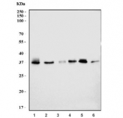 Western blot testing of 1) human HeLa, 2) human 293T, 3) human SH-SY5Y, 4) rat testis, 5) mouse testis and 6) mouse liver tissue lysate with GHITM antibody. Predicted molecular weight: ~37 kDa.