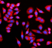 Immunofluorescent staining of FFPE human SiHa cells with GIGYF2 antibody (red) and DAPI nuclear stain (blue). HIER: steam section in pH6 citrate buffer for 20 min.