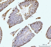 IHC staining of FFPE mouse testis tissue with GIT1 antibody. HIER: boil tissue sections in pH8 EDTA for 20 min and allow to cool before testing.