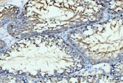 IHC staining of FFPE rat testis tissue with GIT1 antibody. HIER: boil tissue sections in pH8 EDTA for 20 min and allow to cool before testing.