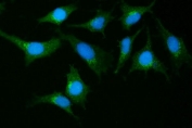 Immunofluorescent staining of FFPE human A549 cells with GIT1 antibody (green) and DAPI nuclear stain (blue). HIER: steam section in pH6 citrate buffer for 20 min.
