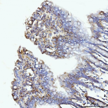 IHC staining of FFPE rat colon tissue with GLUL antibody. HIER: boil tissue sections in pH8 EDTA for 20 min and allow to cool before testing.