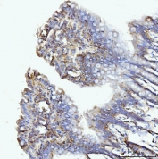 IHC staining of FFPE rat colon tissue with GLUL antibody. HIER: boil tissue sections in pH8 EDTA for 20 min and allow to cool before testing.