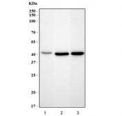Western blot testing of 1) human K562, 2) rat brain and 3) mouse brain tissue lysate with GLUL antibody. Predicted molecular weight ~42 kDa.