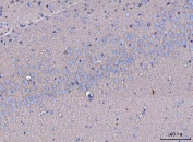IHC staining of FFPE mouse brain tissue with GNB3 antibody. HIER: boil tissue sections in pH8 EDTA for 20 min and allow to cool before testing.