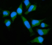 Immunofluorescent staining of FFPE human HeLa cells with GNB3 antibody (green) and DAPI nuclear stain (blue). HIER: steam section in pH6 citrate buffer for 20 min.