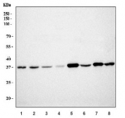 Western blot testing of 1) human HepG2, 2) human HCCT, 3) human HCCP, 4) human Raji, 5) rat brain, 6) rat kidney, 7) mouse brain and 8) mouse kidney tissue lysate with GNB3 antibody. Predicted molecular weight ~37 kDa.