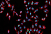Immunofluorescent staining of FFPE human Hep3B cells with Nucleostemin antibody (Dylight 488-conjugated secondary, green), Phalloidin-iFluor 555 conjugate (red) and DAPI (blue). HIER: steam section in pH6 citrate buffer for 20 min.