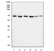 Western blot testing of 1) human HeLa, 2) human K562, 3) human PC-3, 4) human Jurkat, 5) rat C6 and 6) mouse NIH 3T3 cell lysate with Nucleostemin antibody. Predicted molecular weight: ~62/60 kDa (isoforms 1/2).