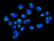 Immunofluorescent staining of FFPE human SiHa cells with Golgin 97 antibody (green) and DAPI nuclear stain (blue). HIER: steam section in pH6 citrate buffer for 20 min.