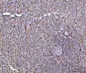 IHC staining of FFPE human spleen tissue with HES5 antibody. HIER: boil tissue sections in pH8 EDTA for 20 min and allow to cool before testing.