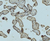 IHC staining of FFPE human placental tissue with HES5 antibody. HIER: boil tissue sections in pH8 EDTA for 20 min and allow to cool before testing.