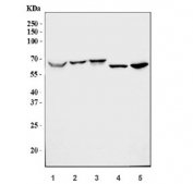 Western blot testing of 1) human 293T, 2) human Caco-2, 3) human HeLa, 4) rat kidney and 5) mouse kidney tissue lysate with Hexosaminidase A antibody. Expected molecular weight: ~60 kDa (precursor), ~54 kDa (mature).