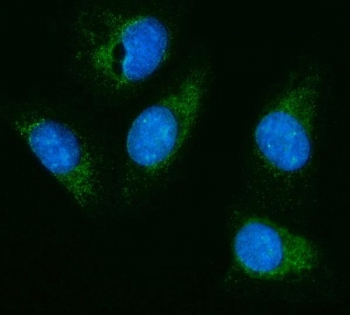 Immunofluorescent staining of FFPE human U-2 OS cells with Hexosaminidase A antibody (green) and DAPI nuclear stain (blue). HIER: steam section in pH6 citrate buffer for 20 min.~