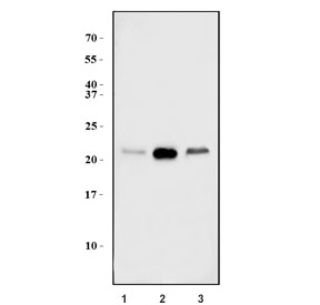 Western blot testing of human 1) MCF7, 2) HEK293 and 3) PC-3 cell lysate with GRPEL1 antibody. Predicted molecular weight ~24 kDa.