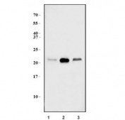 Western blot testing of human 1) MCF7, 2) HEK293 and 3) PC-3 cell lysate with GRPEL1 antibody. Predicted molecular weight ~24 kDa.