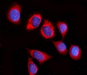 Immunofluorescent staining of FFPE human SiHa cells with GSPT1/2 antibody (red) and DAPI nuclear stain (blue). HIER: steam section in pH6 citrate buffer for 20 min.