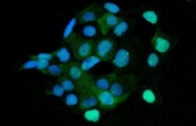 Immunofluorescent staining of FFPE human A431 cells with HMGCS1 antibody (green) and DAPI nuclear stain (blue). HIER: steam section in pH6 citrate buffer for 20 min.