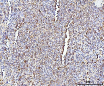 IHC staining of FFPE rat spleen tissue with Il-17a antibody. HIER: boil tissue sections in pH8 EDTA for 20 min and allow to cool before testing.~