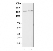 Western blot testing of 1) rat brain and 2) mouse brain tissue lysate with KCNH2 antibody. Expected molecular weight: 127-155 kDa.