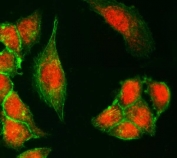 Immunofluorescent staining of FFPE human SiHa cells with KDM6A antibody (Dylight 594-conjugated secondary, red) and Phalloidin-iFluor 488 conjugate (green). HIER: steam section in pH6 citrate buffer for 20 min.