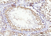 IHC staining of FFPE rat testis tissue with KIFC1 antibody. HIER: boil tissue sections in pH8 EDTA for 20 min and allow to cool before testing.