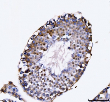 IHC staining of FFPE human testis tissue with KIFC1 antibody. HIER: boil tissue sections in pH8 EDTA for 20 min and allow to cool before testing.