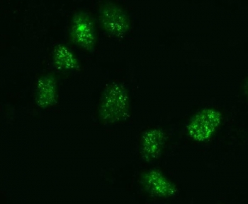 Immunofluorescent staining of FFPE human A431 cells with KIFC1 antibody (green). HIER: steam section in pH6 citrate buffer for 20 min.