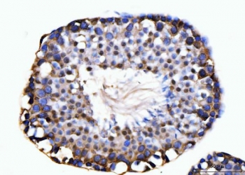 IHC staining of FFPE mouse testis tissue with KIFC1 antibody. HIER: boil tissue sections in pH8 EDTA for 20 min and allow to cool before testing.