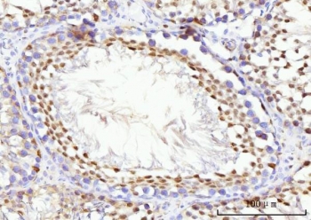 IHC staining of FFPE rat testis tissue with KIFC1 antibody. HIER: boil tissue sections in pH8 EDTA for 20 min and allow to cool before testing.