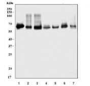Western blot testing of 1) human HepG2, 2) human Caco-2, 3) human RT4, 4) rat liver, 5) rat RH35, 6) mouse liver and 7) mouse HEPA1-6 cell lysate with LSR antibody. Predicted molecular weight: 54-71 kDa (multiple isoforms).